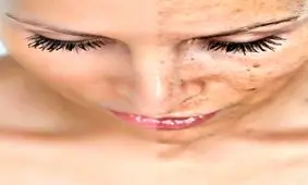 پوست شما آينه كبد شماست