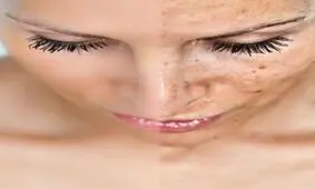 پوست شما آينه كبد شماست