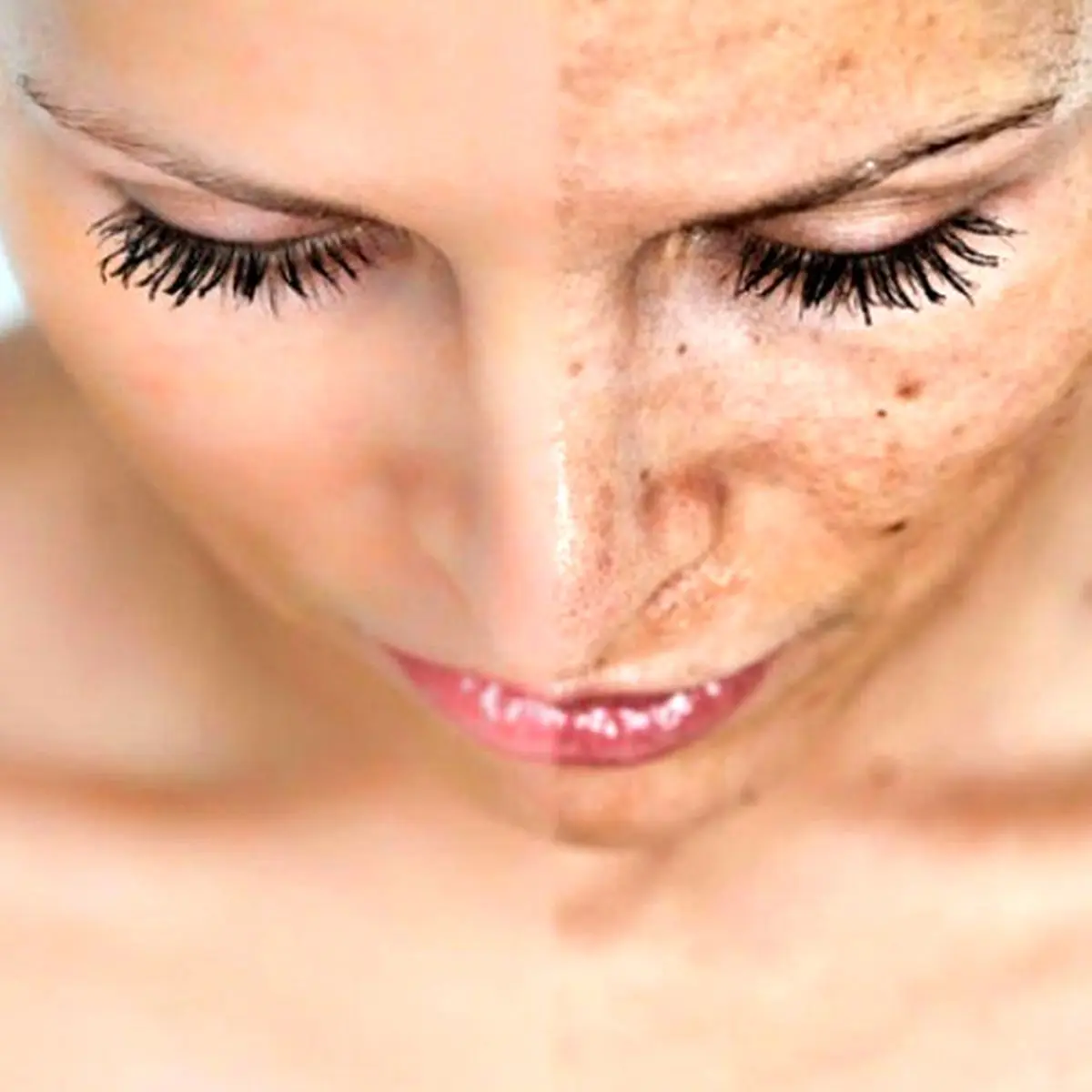 پوست شما آينه كبد شماست