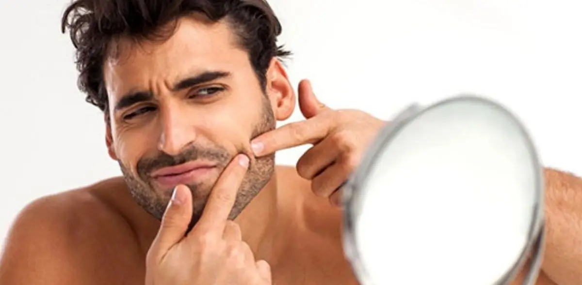 ترکاندن جوشها ممکن است منجر به مرگ شود!!!