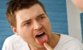 اگر احساس تلخی در دهان می کنید این بیماری در کمین شماست