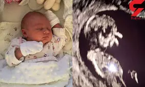 عجیب ترین بارداری دنیا