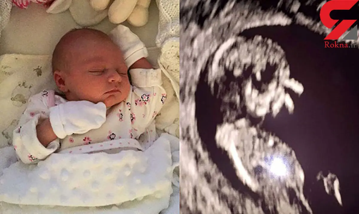 عجیب ترین بارداری دنیا