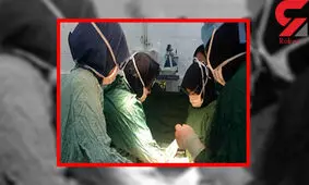 کیست 17 کیلوگرمی در شکم زن 72 ساله قزوینی جا خوش کرده بود+عکس