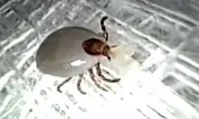 خارج کردن حشره عجیب از داخل گوش بیمار ! + فیلم