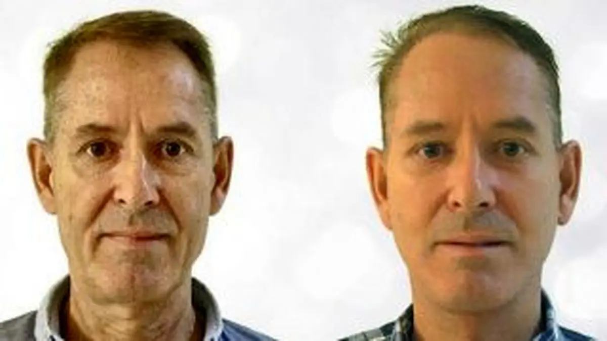 ۷ راه موثر برای پیشگیری از افتادگی پوست