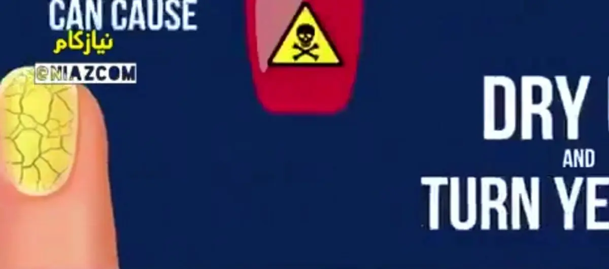 چرا به « لاک ناخـــــن » سمّ خوش آب و رنگ میگویند؟