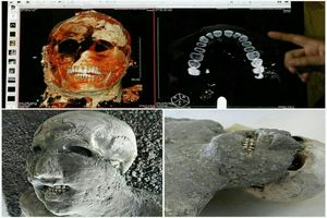 علت دندانهای سالم مردم روم باستان