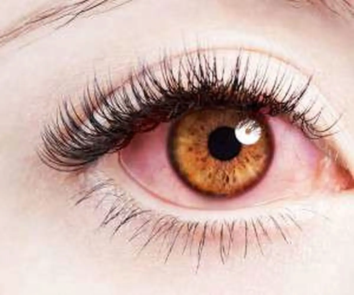 حقایق باورنکردنی در مورد چشم ؛ موجودی با 12 چشم و 3 پلک