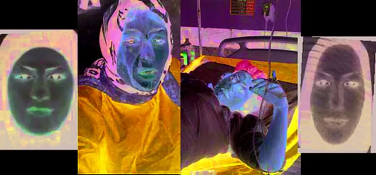 ماجرای مادر ١٨ ساله‌ای که بی‌گناه سوخت