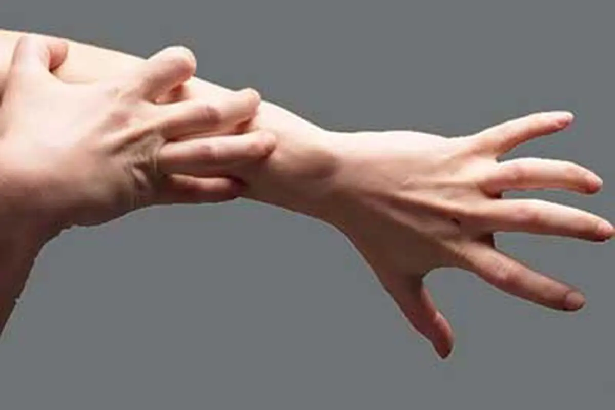 توصیه‌هایی برای کنترل خارش‌ پوست