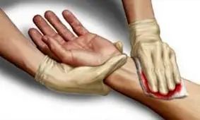 ویدئو/ بند آوردن خون در ده ثانیه!