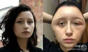 تغییر چهره عجیب دختر جوان بخاطر رنگ موی تقلبی!! عکس