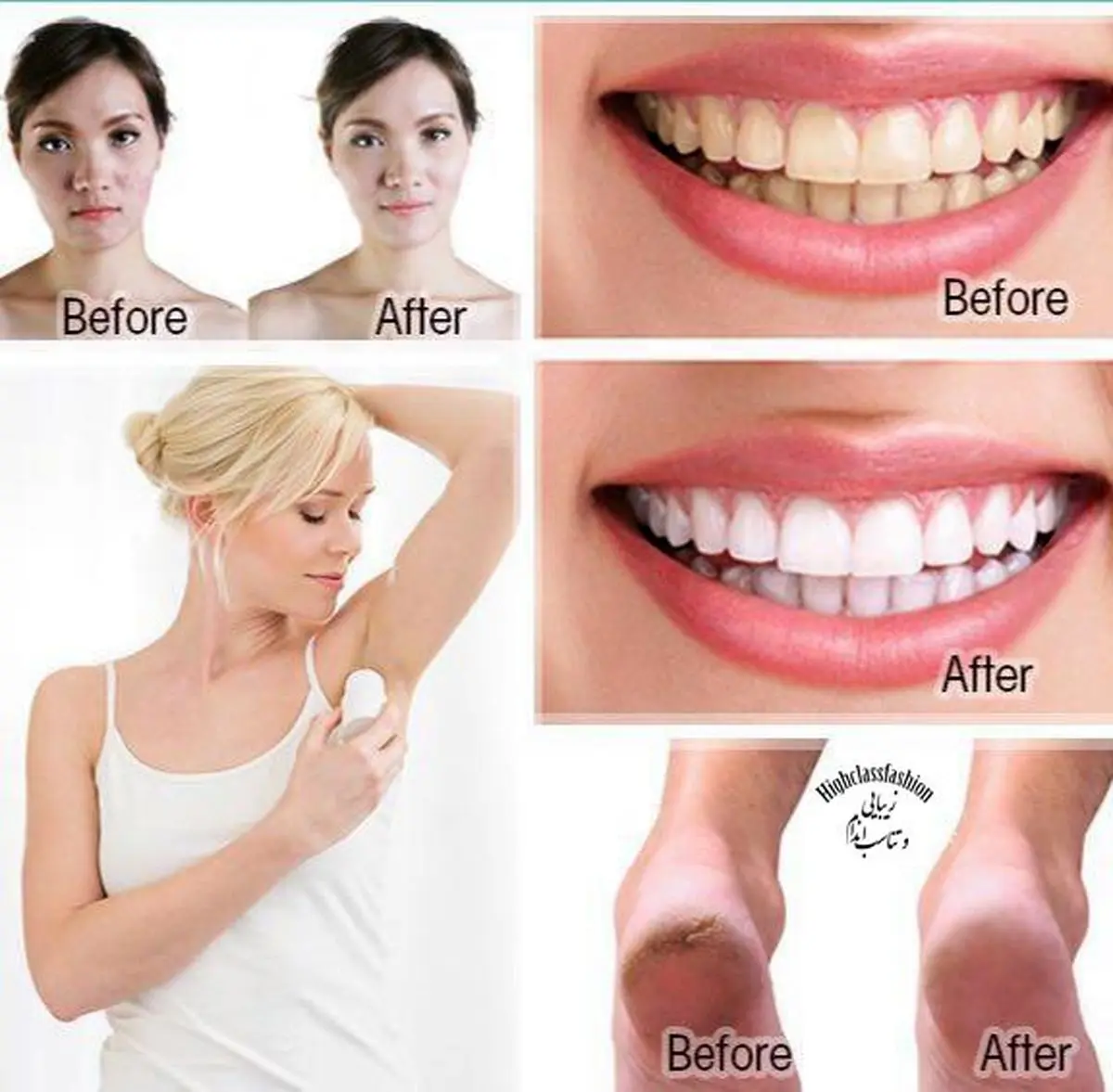 معجزه ای بنام جوش شیرین