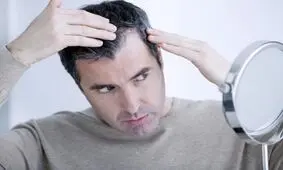 وقتی ژنتیک نقشی در ریزش مو ندارد