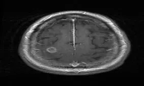 آب لوله کشی مغز یک زن را خورد !!!