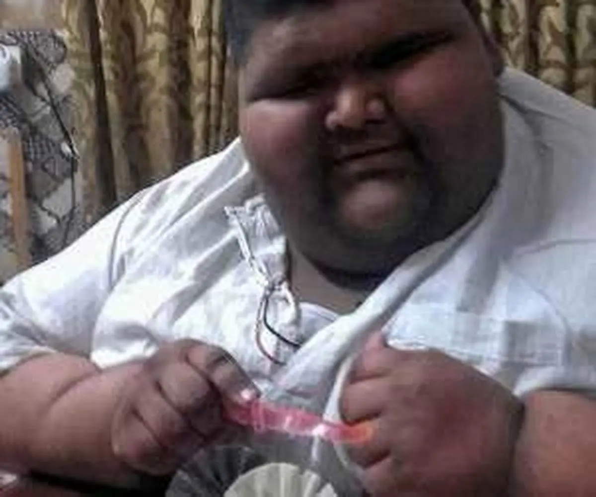 پسر 237 کیلویی بالاخره لاغر شد + تصاویر