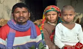 بیماری عجیب پسری که به سنگ تبدیل می شود! +تصاویر