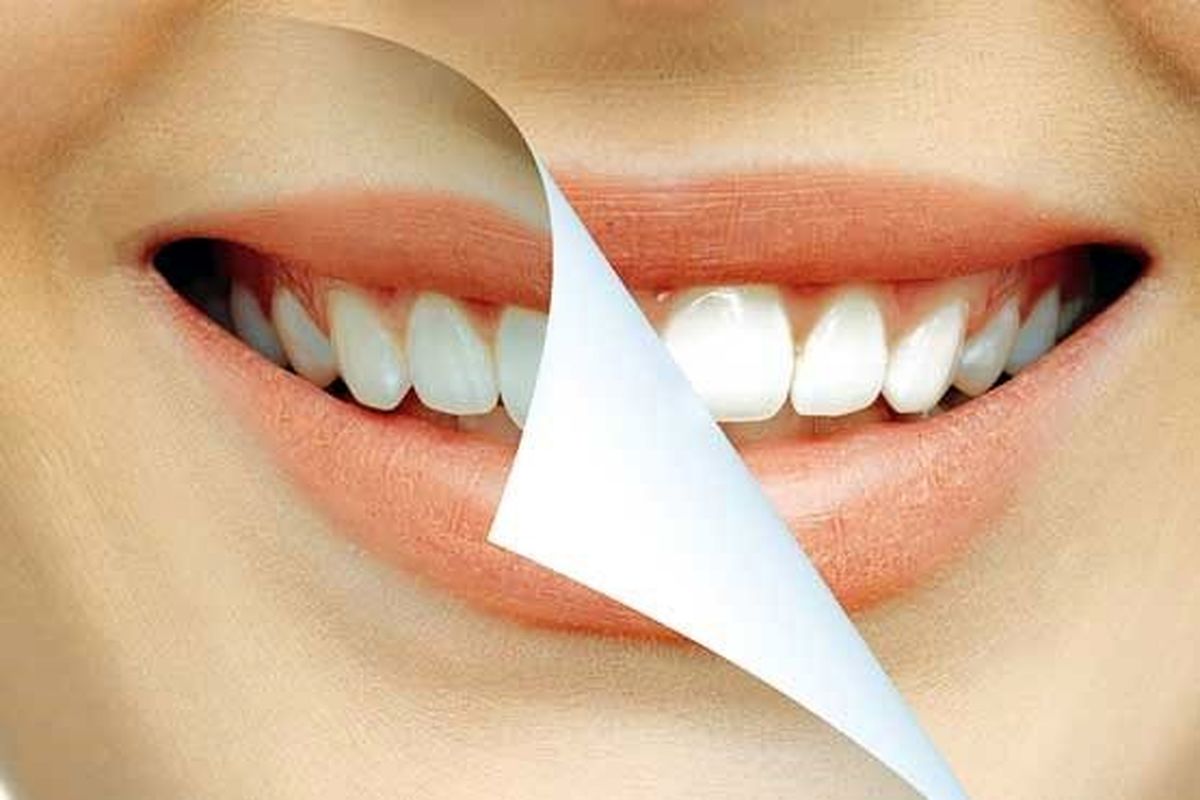 مواد خوراکی مضر برای دندانها را بشناسید
