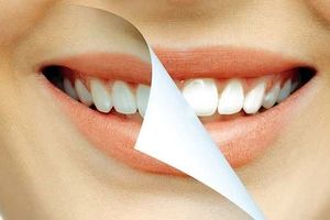 مواد خوراکی مضر برای دندان‌ها را بشناسید