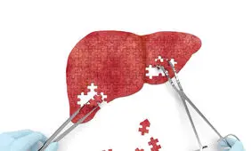 خطر کبد چرب در کمین شماست + فیلم