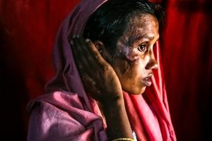بازماندگان فاجعه روهینگیا‎ +تصاویر