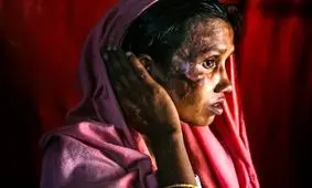 بازماندگان فاجعه روهینگیا‎ +تصاویر