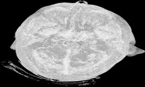 ۱۰ حقیقت عجیب و جالب درباره بدن انسان که شگفت‌زده‌تان می‌کند! + تصاویر