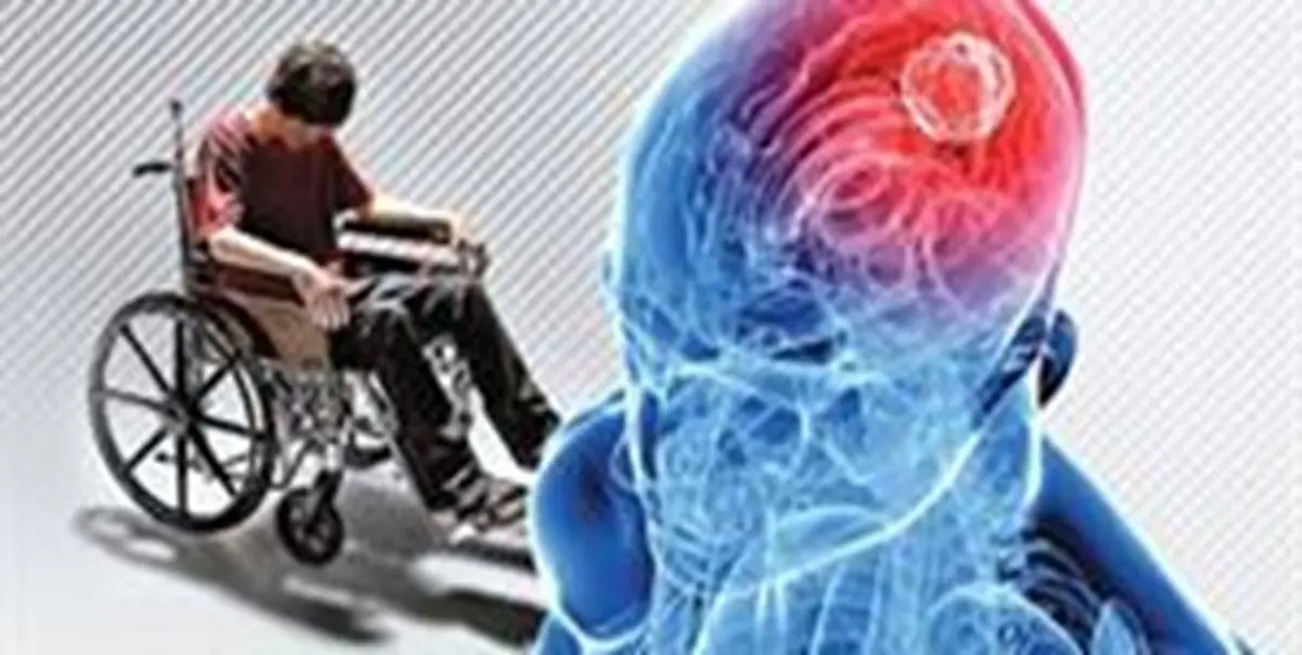 بررسی نقش استرس در ایجاد و تشدید ام اس