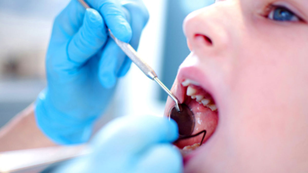 عفونتی خطرناک که در دندان هایتان نهفته است