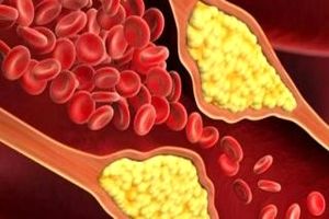 ۵ راه خانگی برای تنظیم کلسترول خون