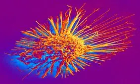 قرص‌های قند و فشار سلول‌های سرطانی را می‌کشند