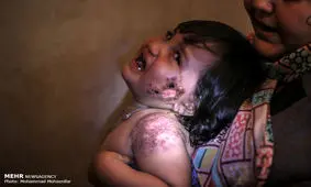 خشکسالی زاینده‌رود و تعطیلی کشاورزی در شرق از عوامل شیوع سالک است