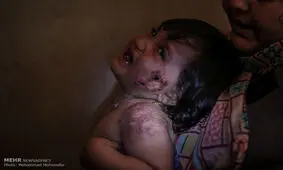 خشکسالی زاینده‌رود و تعطیلی کشاورزی در شرق از عوامل شیوع سالک است