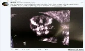 وحشت مادر از عکس سونوگرافی جنین داخل شکمش + عکس