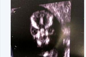 وحشت مادر از عکس سونوگرافی جنین داخل شکمش + عکس