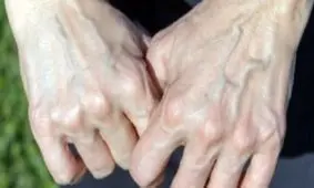 ۷ دلیل پیر شدن دست‌ها