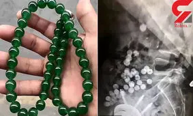 روده این خلافکار ارزش میلیاردی دارد!+عکس