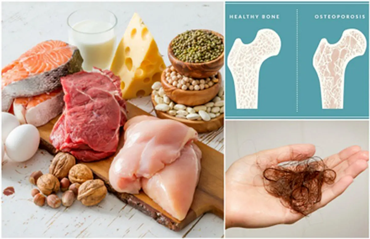 نشانه‌هایی که به شما می‌گوید کمبود پروتئین دارید