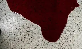 قتل عجیب زن جوان مجهول‌الهویه با ضربات متعدد جسم نوک‌تیز