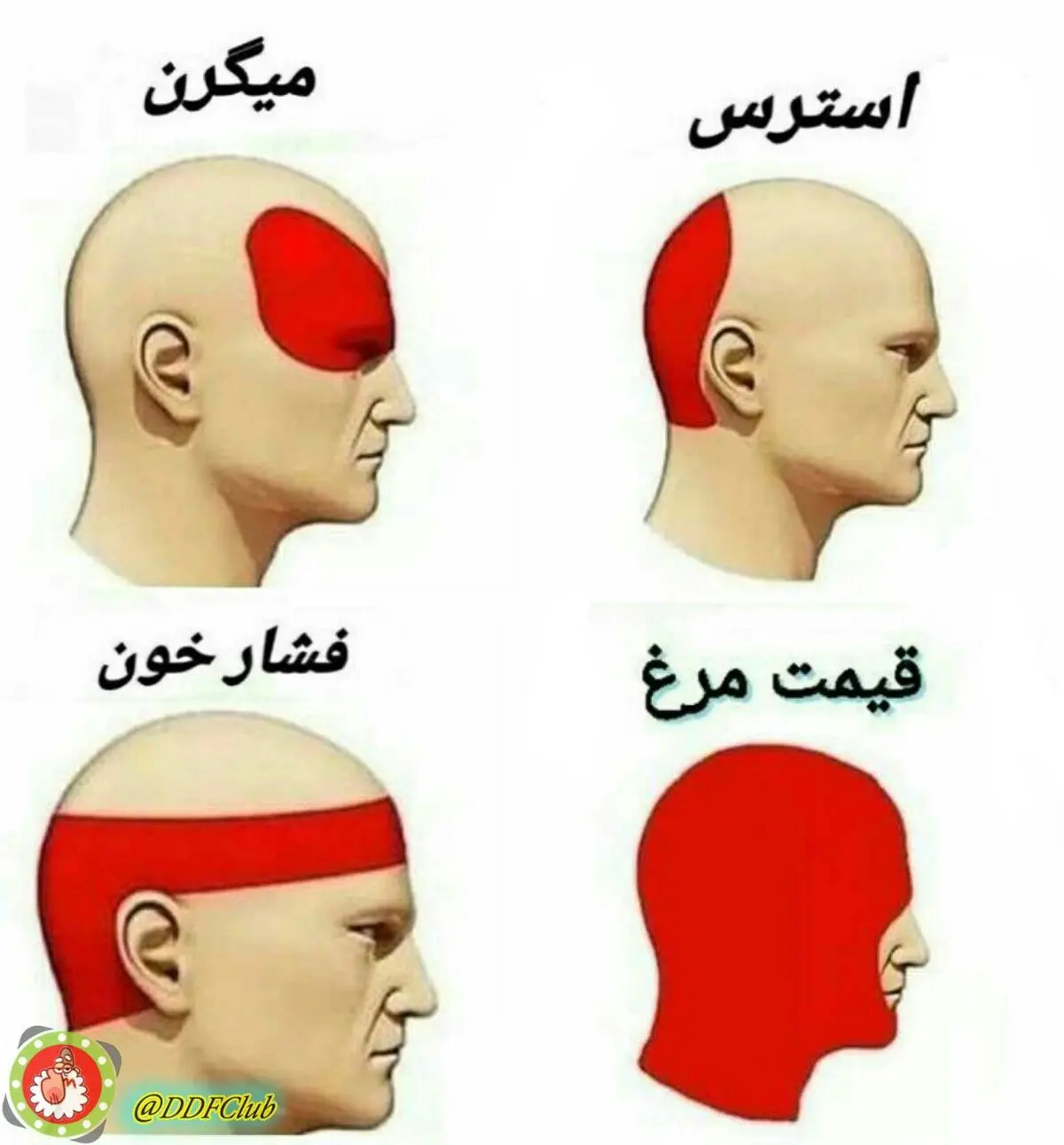 علت اصلی سردرد ها