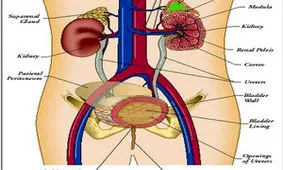 ادرار دردناک همراه با سوزش