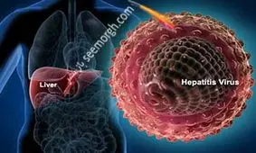 آشنایی با انواع هپاتیت A ، B و C و روش های انتقال آن ها
