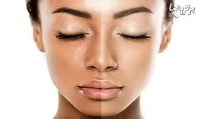 سفید کردن پوست با روش‌های خانگی