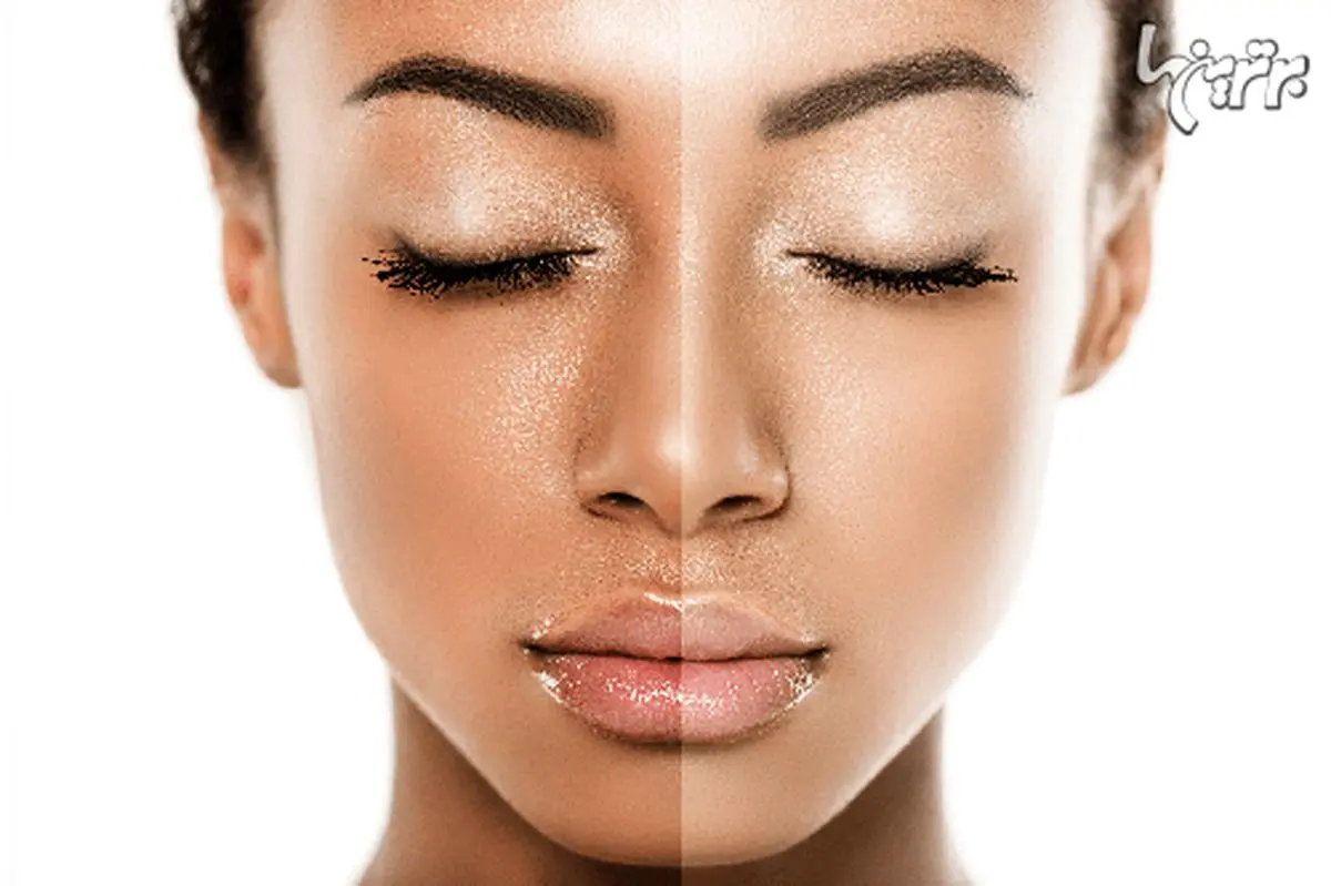 سفید کردن پوست با روش‌های خانگی