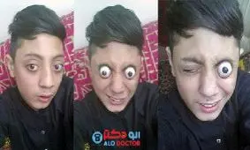 پسری که چشمانش از حدقه بیرون می زند!