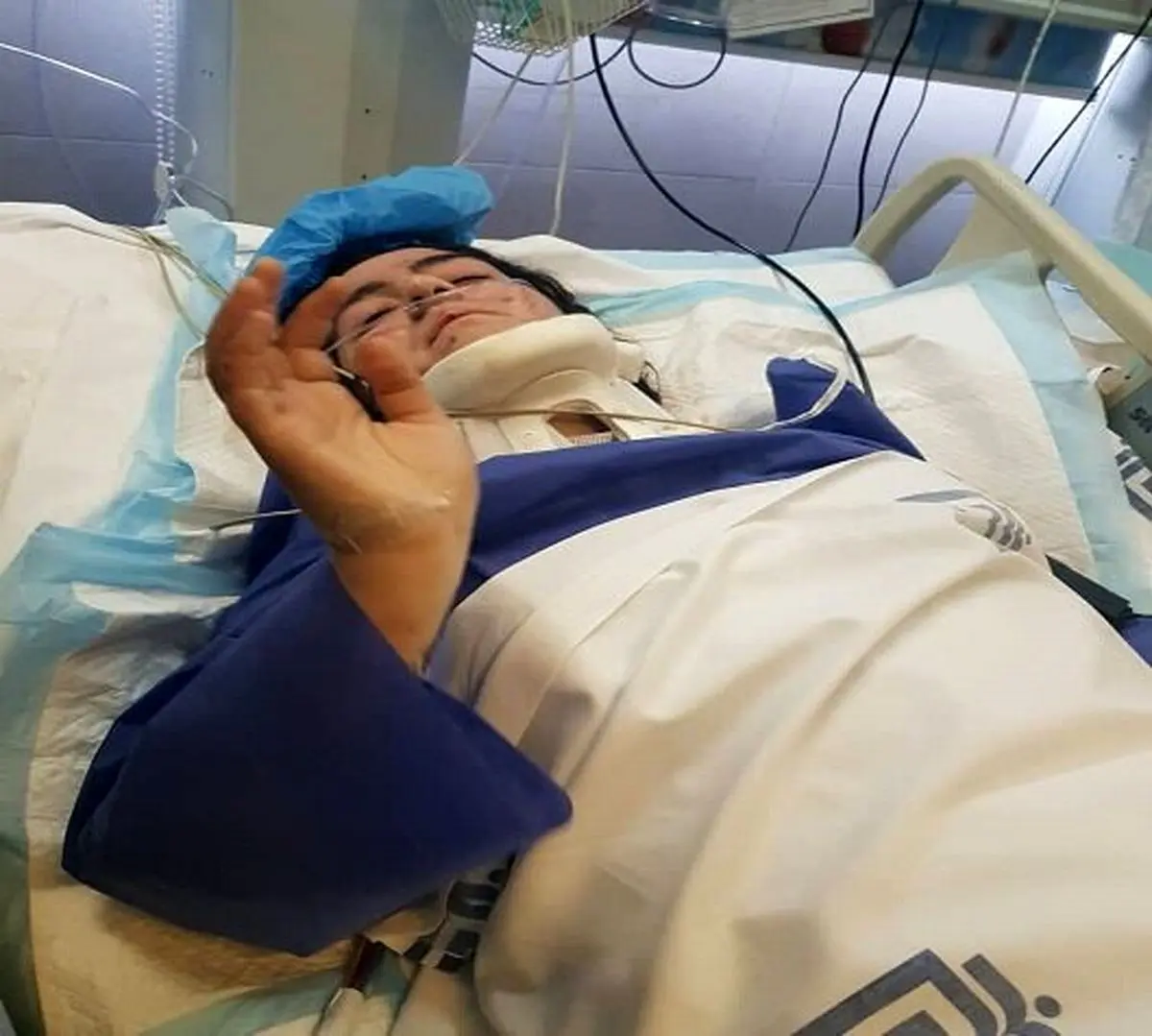 وضعیت سه دانشجوی بدحال بیمارستان امام رو به بهبودی است