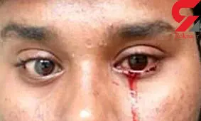 این مرد خون گریه می کند + عکس