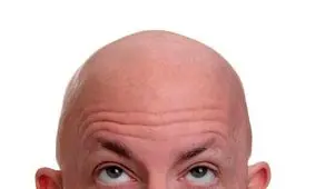 همه آنچه درباره ریزش موی مردان باید بدانید+ راهکارهای درمانی