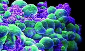 بیمارستان ۲۰۰ تختخوابی بیماران سرطانی در مشهد راه‌اندازی می‌شود